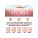 MAC جهاز إزالة الشعر MC-33 من ماك (900000 ذرة) épilation laser